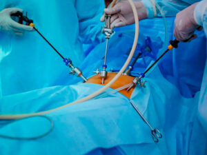 cirurgias bariátricas revisionais