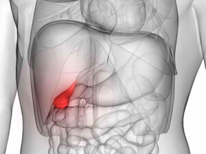 doenças da vesícula biliar
